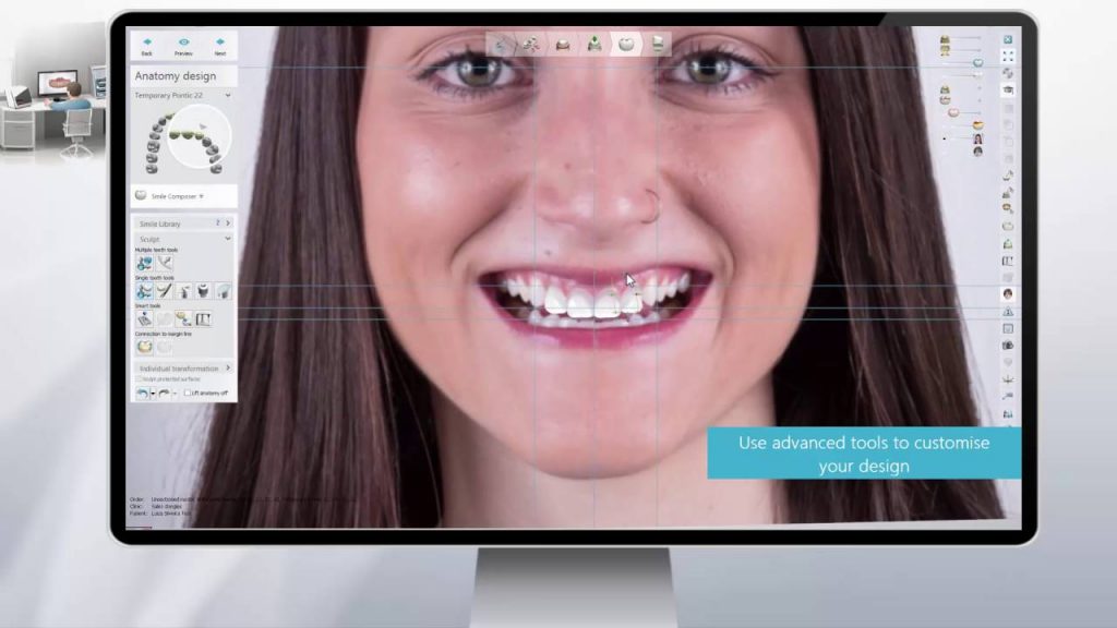 Top 5 Smile Design Software: Choose the best 34