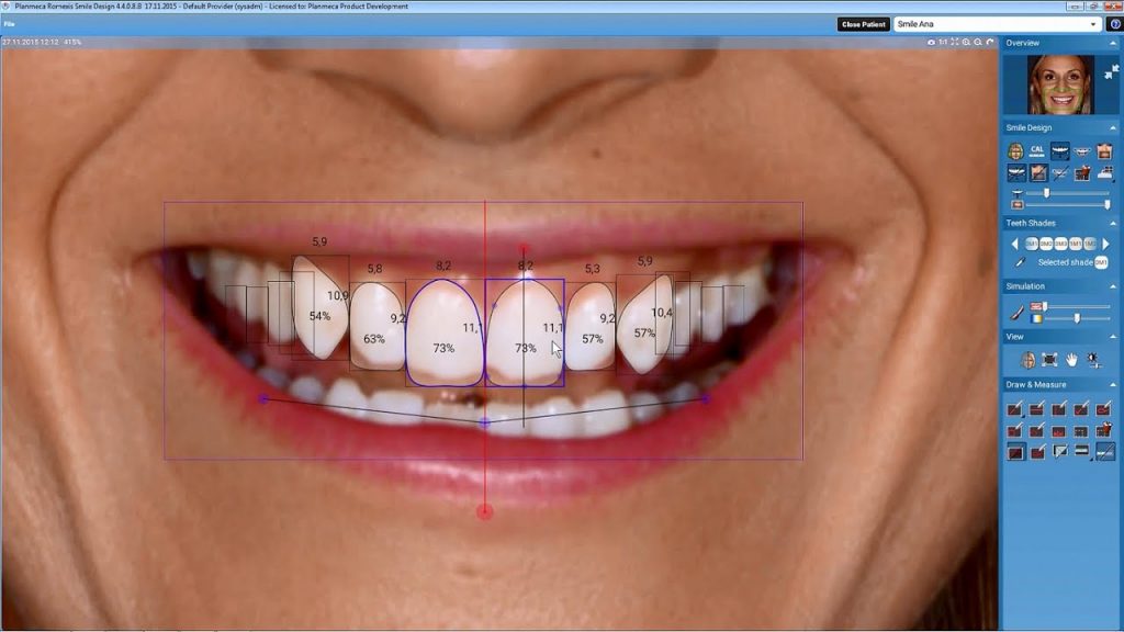 Top 5 Smile Design Software: Choose the best 32