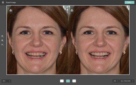 Top 5 Smile Design Software Tools for Perfecting Your Smile 21