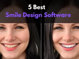 Best Smile Design Software